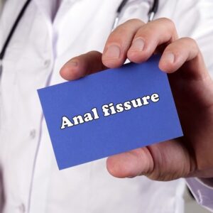 How Bidets Can Aid in the Prevention of Anal Fissures